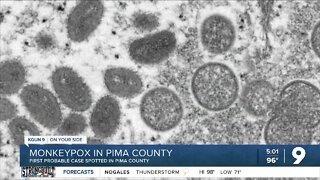 Monkeypox in Pima County