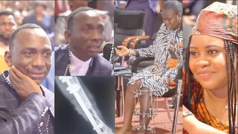 SISTER EKE CHINEMEREM TINCO'S TESTIMONY || NEARLY AMPUTATED LEG CAUSED BY CAR ACCIDENT HEALED