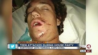 Teen recovering after being jumped at Cape party