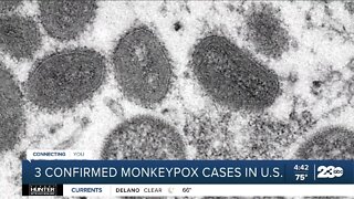 CDC monitoring U.S. monkeypox cases