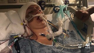 23-year-old woman survives massive brain bleed thanks to Saint Luke's surgeons