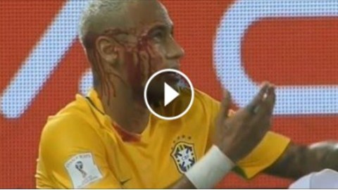 Neymar's face covered with blood ... That's awful :( :( :( Brazil 5-0 Bolivia