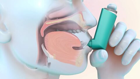 Como usar un inhalador de dosis medidas