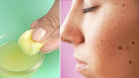 How To Use Lemon For Dark Spots | Health and Nutrition Channel