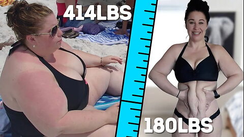 I Lost 230lbs - But Can Surgery Fix My Excess Skin? | BRAND NEW ME