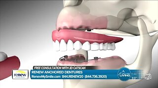 FREE Consultation and CAT Scan - Renew Anchored Dentures