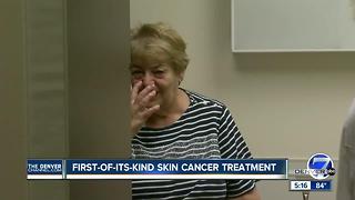 First-of-its- kind skin cancer treatment