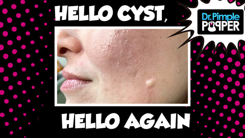 Hello cyst Again, Hello...