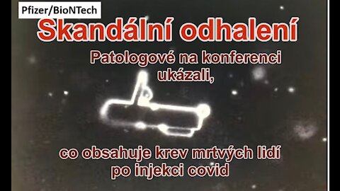 Skandální odhalení patologů, co obsahují injekce Covid!