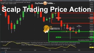 Day Trading Fast System For Any Market - Anyone Can Learn the Trade Scalper