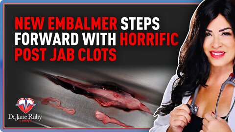 New Embalmer Steps Forward With Horrific Post Jab Clots