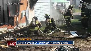 Man severely burned in Pasco house fire