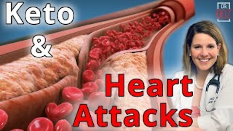 Keto and Heart Attacks, What causes a heart attack? - Dr. Boz