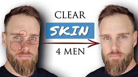 How to GET CLEAR SKIN for MEN || Advanced Skincare Secrets