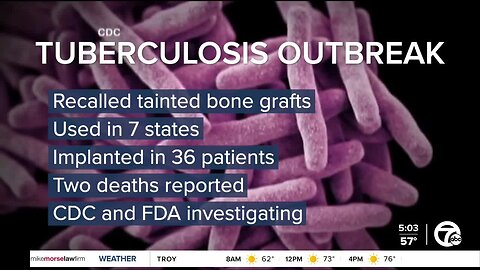 Tuberculosis death of MI woman linked to tainted bone graft after surgery