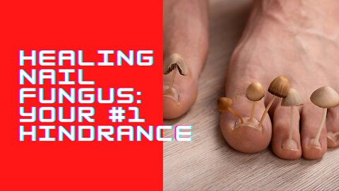 Healing Nail Fungus: Your #1 Hindrance