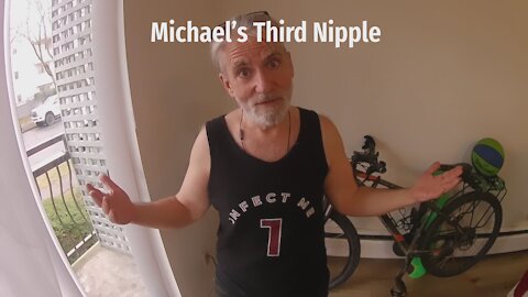 Michael's Third Nipple