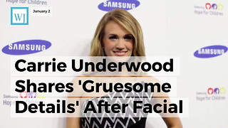 Carrie Underwood Shares 'Gruesome Details' After Facial Injury 'Between 40 And 50 Stitches'