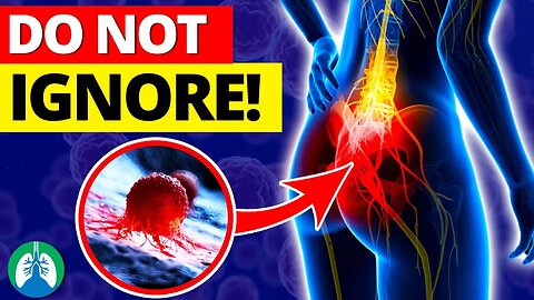 Top 10 Early Warning Signs of Colon Cancer [Warning] ⚠️