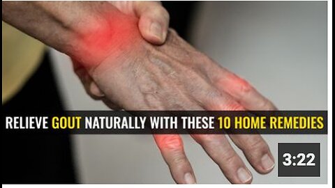 Relieve gout naturally with these 10 home remedies