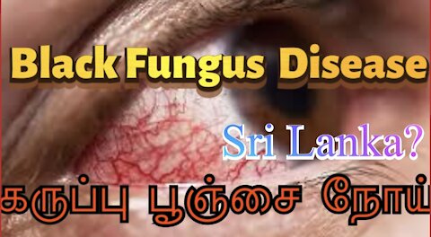 Black fungus disease | Sri Lanka |கருப்பு பூஞ்சை நோய்