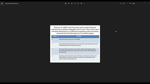 Spinal Degeneration Based On This