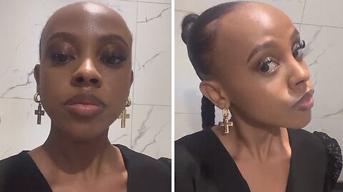 Hilarious Girl Embraces Her Big Forehead With Playful Wit
