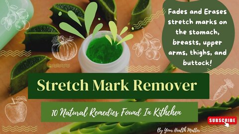 Stretch Marks Removal For Men & Women At Home | Natural Treatment & Prevention