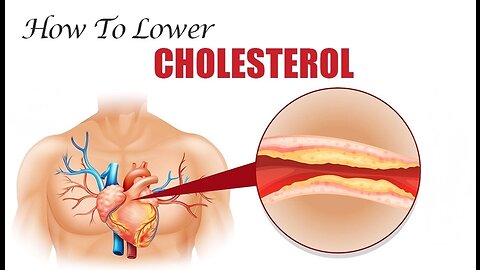 How To Lower Your Cholesterol