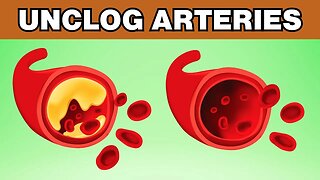 7 Proven Foods to Unclog Arteries Naturally