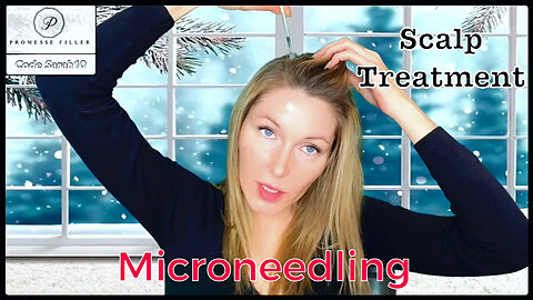 #Hair #REGROWTH #microneedling #hairserum #scalptreatment