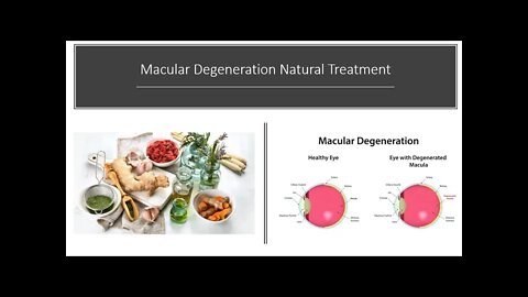Macular Degeneration Natural Treatment