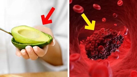 Eat These Foods To Prevent Blood Clots, Heart Attacks And Strokes
