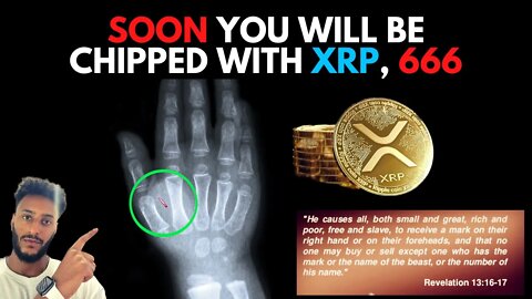 Are you ready to sacrifice your XRP to be microchipped