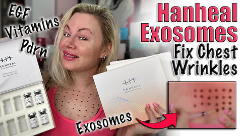 Fix Chest Wrinkles with Hanheal Exosomes, AceCosm| Code Jessica10 Saves You Money