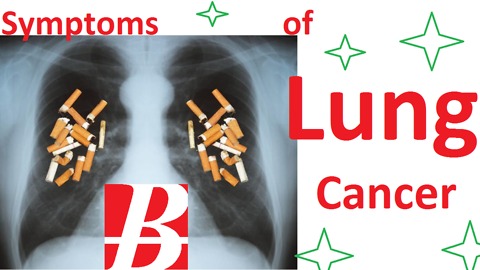 9 Early Signs of Lung Cancer