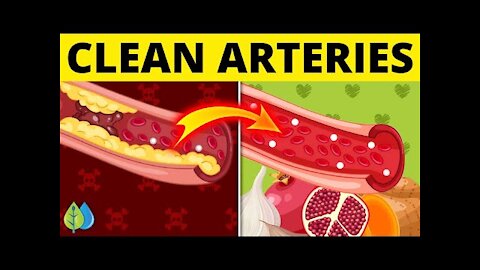 ❣️Top 7 Foods that Unclog Arteries Naturally and Prevent Heart Attack