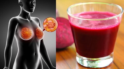 6 Reasons To Have A Glass Of Beet Juice Every Day (Beet Juice Benefits)