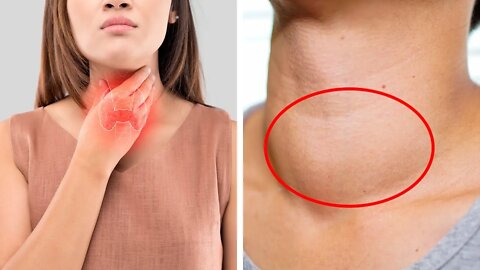 7 Signs of Thyroid Problems You Should Never Ignore