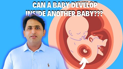 Can a Baby Develop Inside Another Baby? Possible? کیا ایک بچہ دوسرے بچے کے اندر نشوونما پا سکتا ہے؟