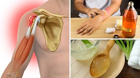 6 Home Remedies for Tendinitis That Actually Work (Tendonitis)