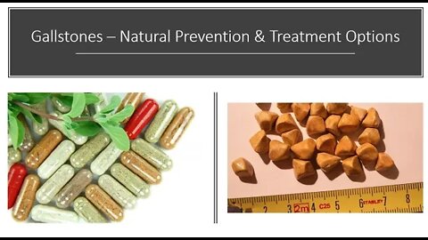 Gallstones - Natural Prevention & Treatment Options