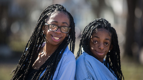 These Inspirational Sisters Share The Same Rare Facial Disorder