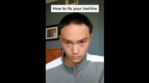 Hiw to fix your hairline