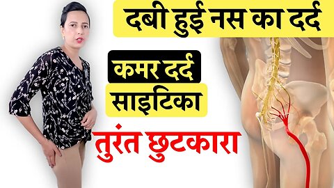 कमर में दबी हुई टांग की नस का इलाज | पैरों में दर्द झनझनाहट सुन्नपन | Sciatica, Disc Bulge, Leg Pain