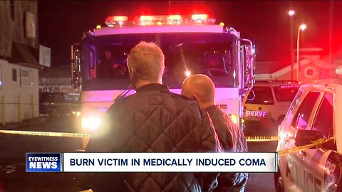 Burn victim in medically induced coma