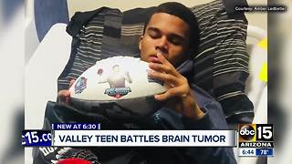 Team rallies behind football player diagnosed with brain tumor