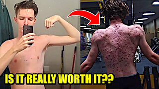 A 20yr Old Idiot Takes Steroids & This Happens!