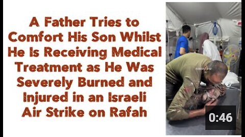A Father Tries to Comfort His Son Whilst He Is Receiving Medical Treatment as He Was Severely Burned