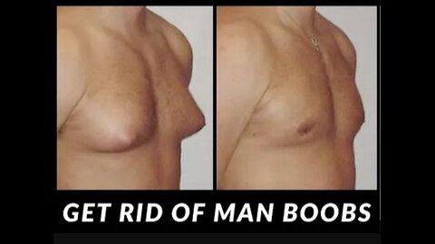 Say by to Man boobs in 10 days. How to remove chest fat and puffy nipples.